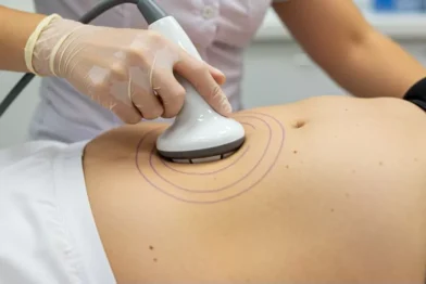 Lipocavitação (ultrassom para gordura localizada)